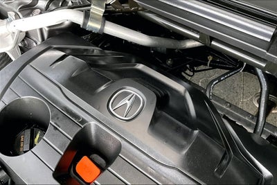 2025 Acura TLX Technology Package